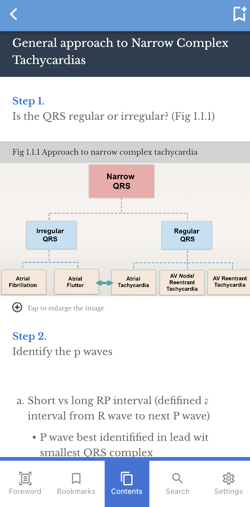 Useful teaching instructions and illustrations for ECG interpretations (1) - NHCS