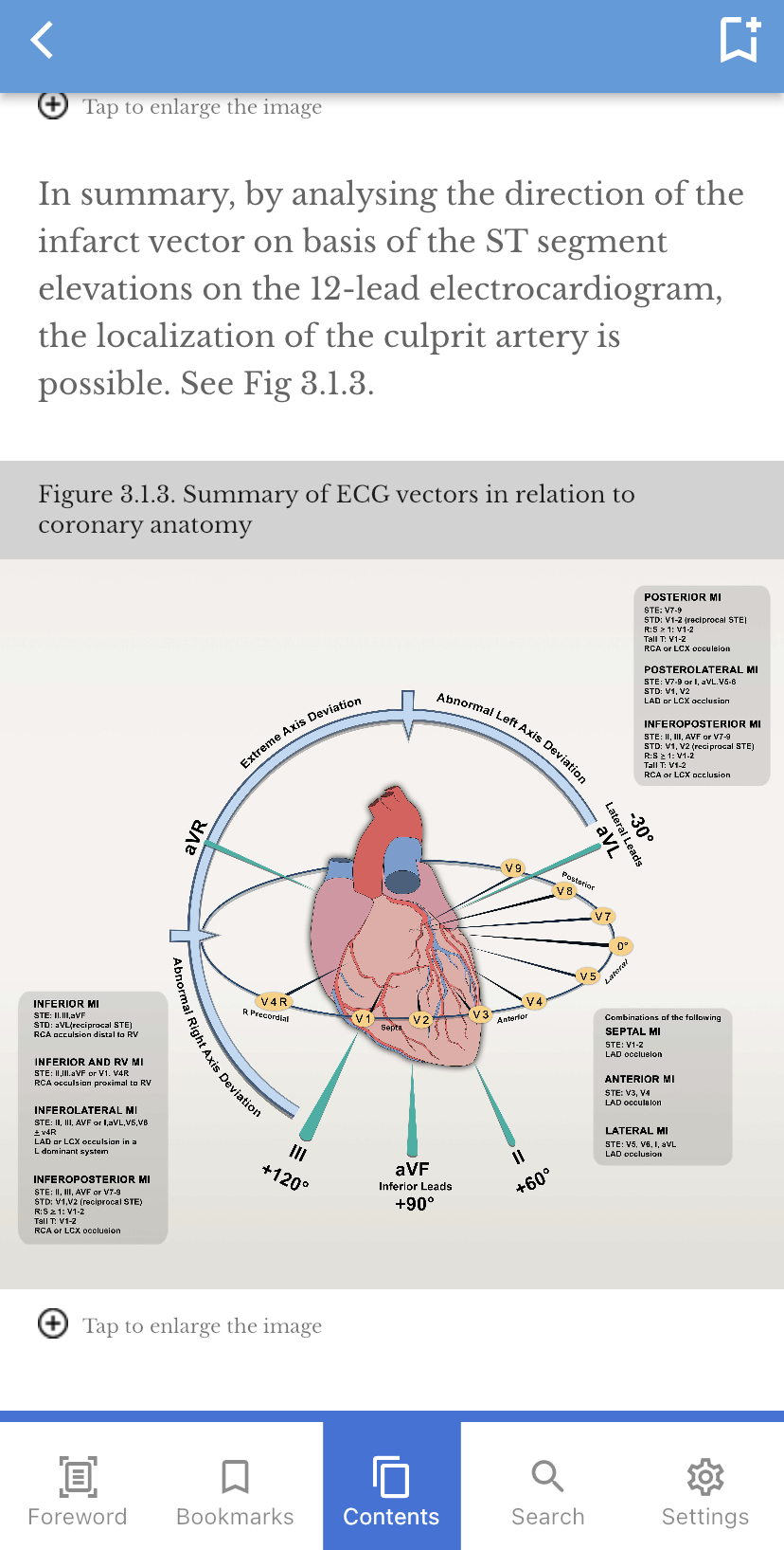 Useful teaching instructions and illustrations for ECG interpretations (2) - NHCS