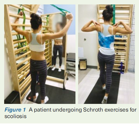 A patient undergoing Schroth exercises for scoliosis - SingHealth Duke-NUS Spine Centre