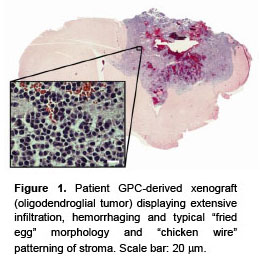NNI Glioma-Propagating Cells.jpg