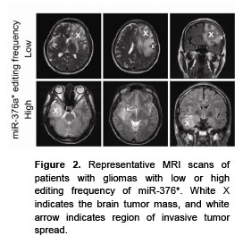 NNI Tumor Cell Invasiveness.jpg