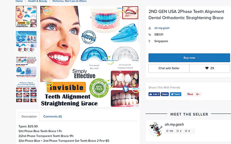 are put up for sale freely on online platforms like Carousell and Qoo10. They purportedly push the teeth into proper alignment over a period of a few months, but their use may lead to problems such as poor fit or unwanted tooth movement.