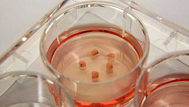 The "mini-brain" created neuromelanin, a pigment found in the human midbrain, which has been associated with protecting cells from dying, and is diminished in the brains of patients with Parkinson's.  PHOTO A*STAR'S GENOME INSTITUTE OF SINGAPORE. 