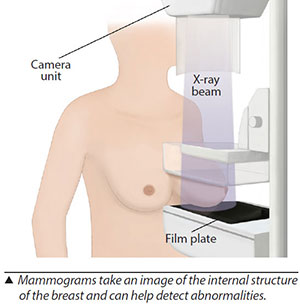 Mammogram Screening