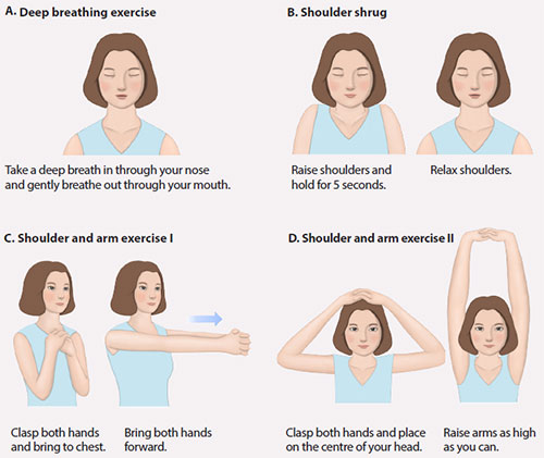 Exercises After Breast Surgery - StoryMD