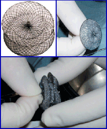 Device Closure Of Atrial Septal Defect - Amplatzer Septal Occluder - KKH