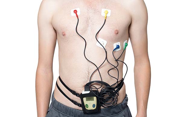 ambulatory electrocardiogram or holter monitoring test conditions and treatments