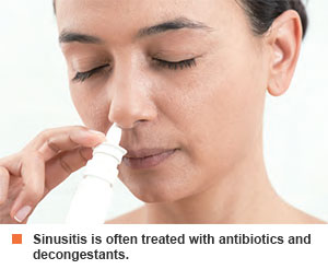 Treatment for sinusitis - SGH